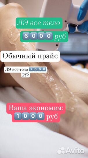 Лазерная эпиляция