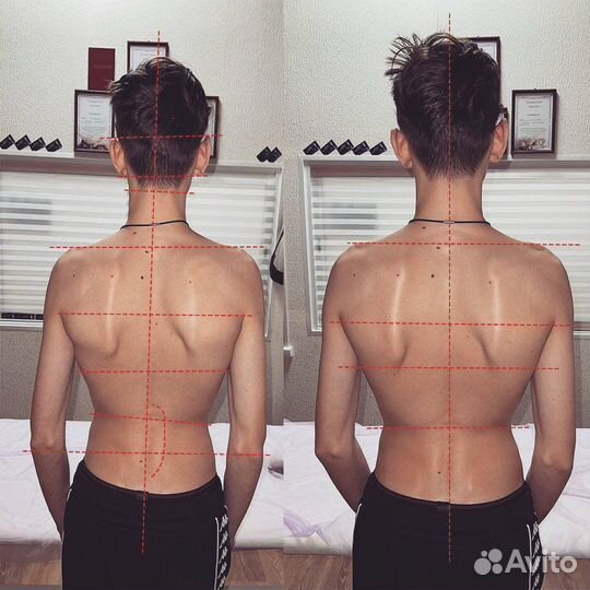 Мануальный массаж (Костоправ )