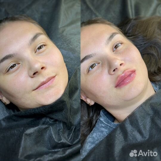 Услуги косметолога