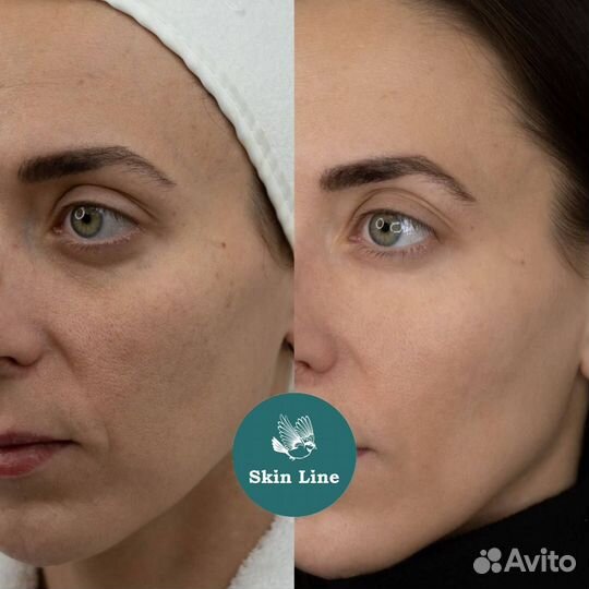 Модели / микротоки / омолаживание