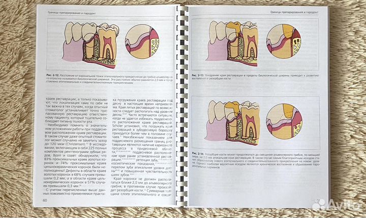 Основы препарирования зубов