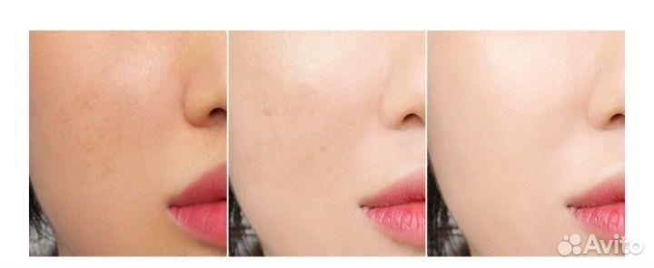 Отбеливающий лосьон для лица и тела