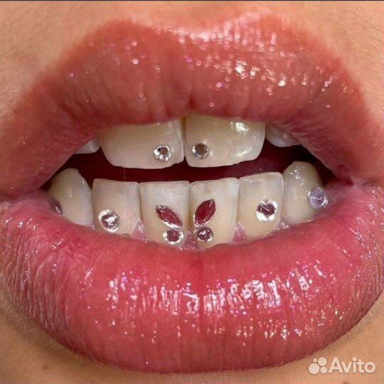 Скайсы установка