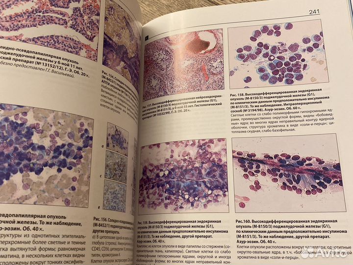 Цитологическая диагностка опухолей