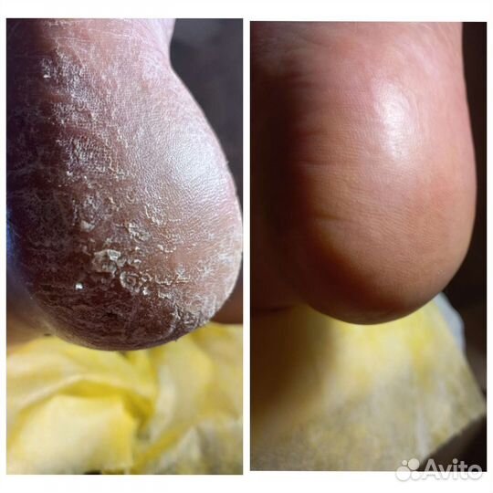 Маникюр педикюр