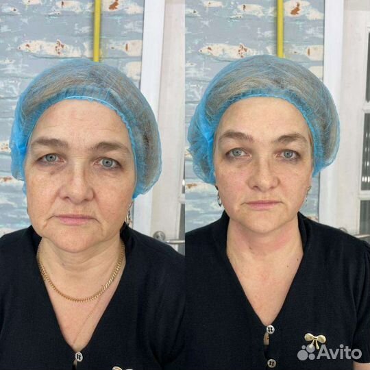 Консультация косметолога