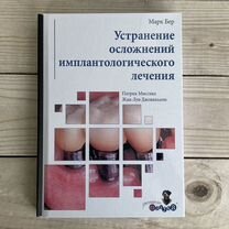 Устранение осложнений имплантологического лечения