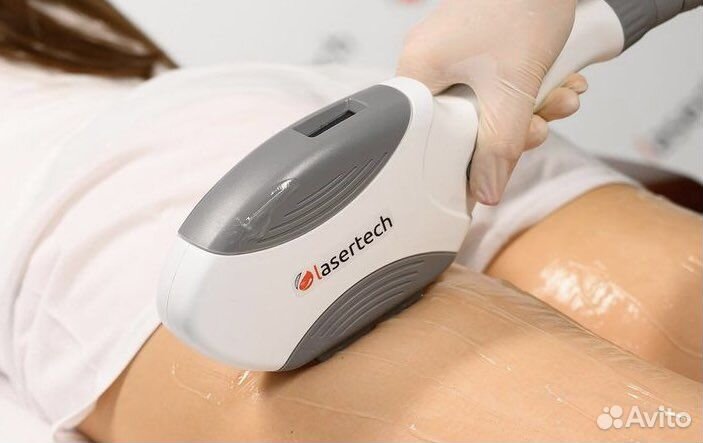 Элос эпиляция