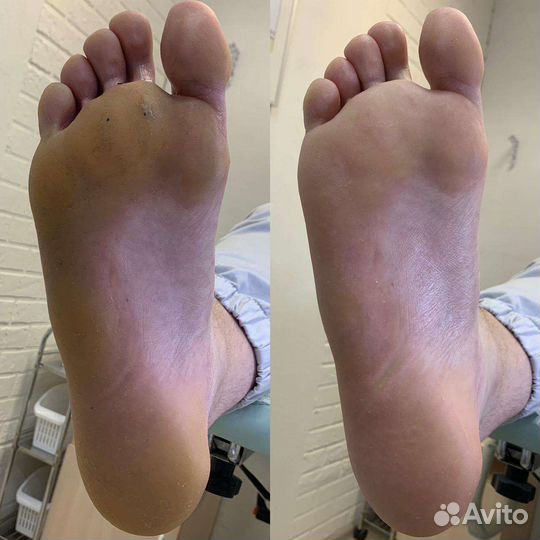 Педикюр,подологические услуги с выездом на дом