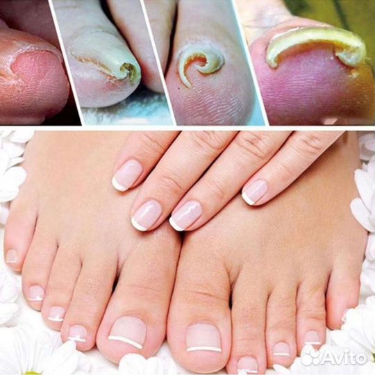 Наращивание ногтей