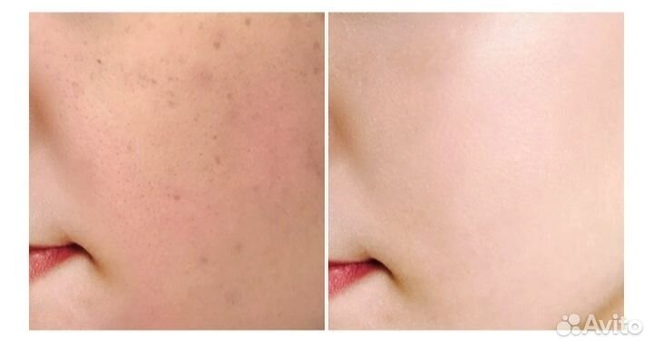 Отбеливающий лосьон для лица и тела