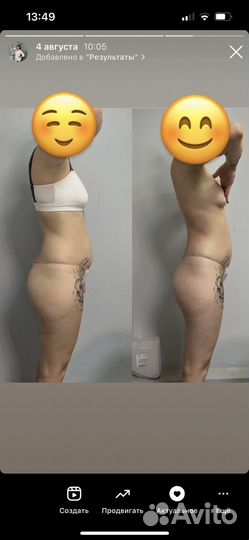 LPG, вакуумный, вибромассаж, антицеллюлитный