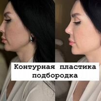 Модель на контурную пластику лица