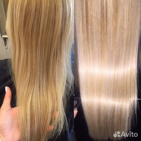 Нанопластика, ботокс, Биксипластия