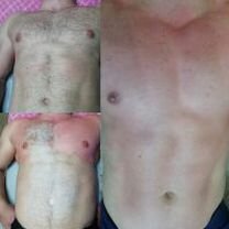 Депиляция мужская и женская, Саратов