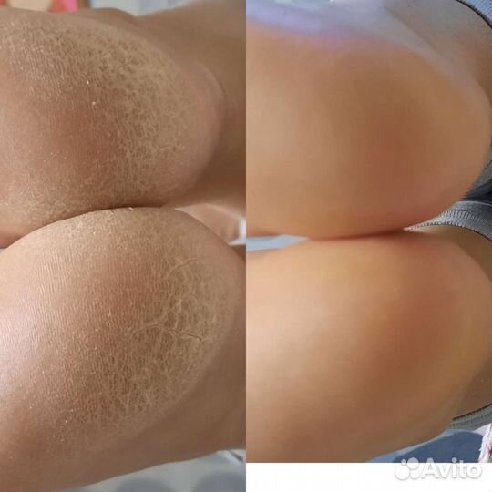 Маникюр, педикюр, наращивание