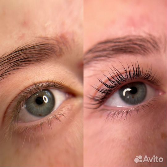 Ламинирование ресниц +Ботокс Симферополь