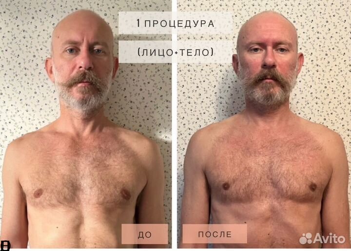 Глубокотканный массаж лица.Массаж тела