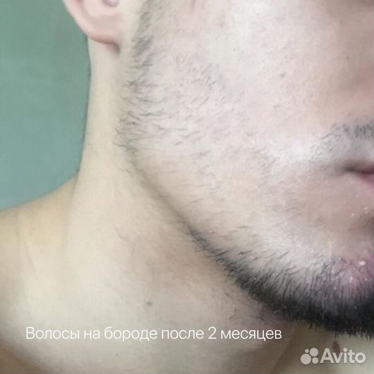 Набор для роста волос