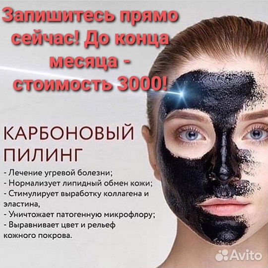 Карбоновый пилинг