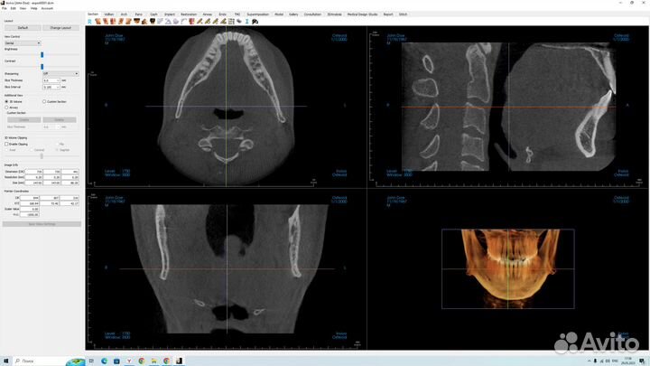 Invivo Dental 7.1 full 2023