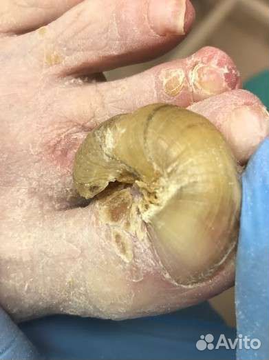 Подолог медицинский педикюр