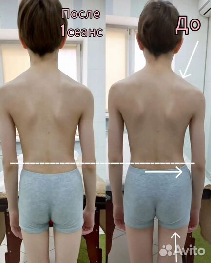 Массаж Кинезио, Здоровая спина, Остеобаланс