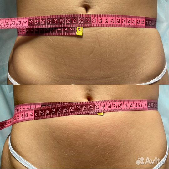 Оздоровительный массаж (коррекция фигуры), лицо