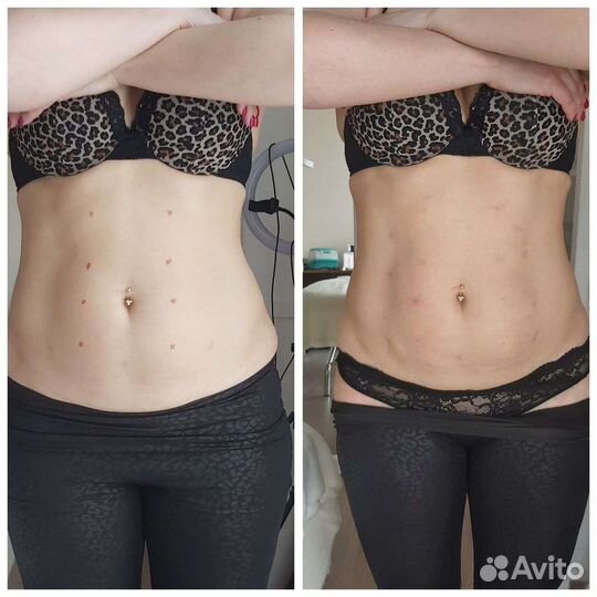 Супер сушка живота