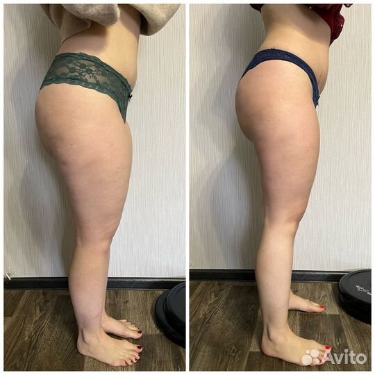 Массаж Луганск