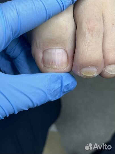 Подолог, медицинский педикюр, педикюр