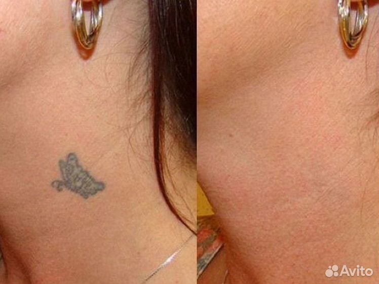 Основной альбом - Фотография 7 из 10 ВКонтакте