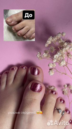 Смарт педикюр