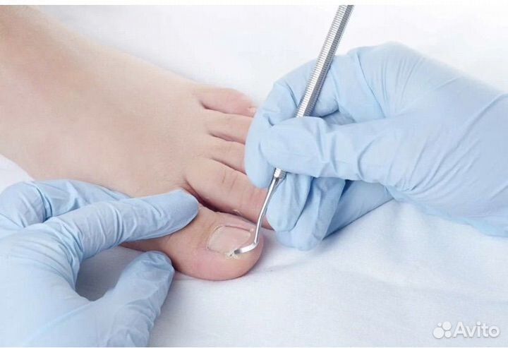 Услуги подолога