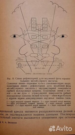 Синдром и болезнь Меньера. Кузьма Великов