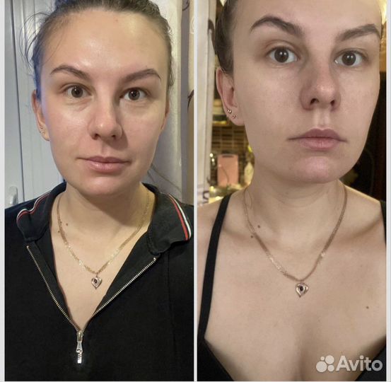 Драйнэффект