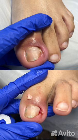 Курсы подологии