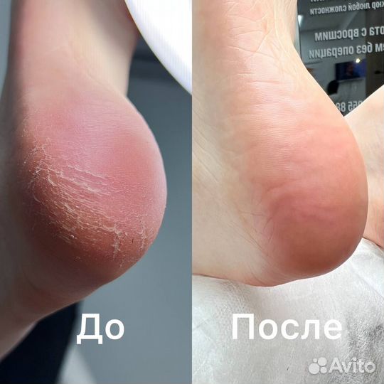 Маникюр/педикюр с покрытием гель-лаком