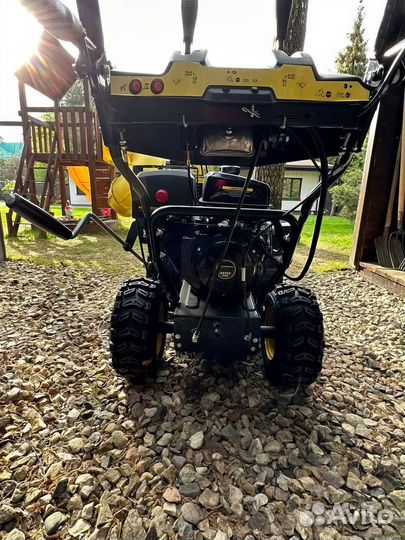 Снегоуборщик Champion Чемпион ST1170E 8,1 л.с