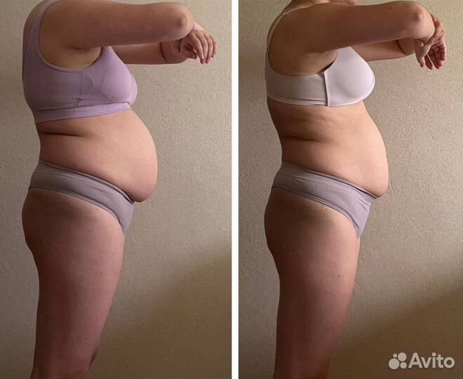 Лечебный массаж