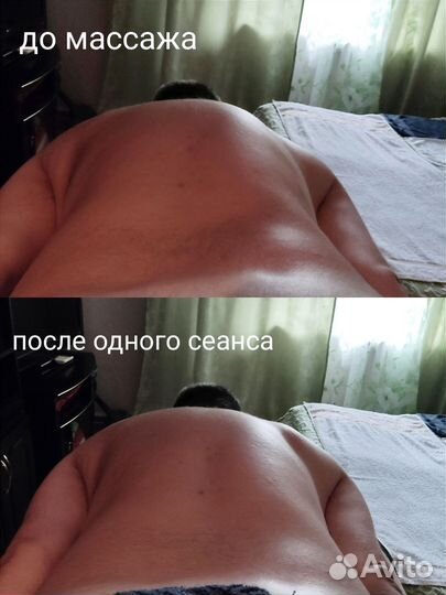 Услуги опытного массажиста на дому