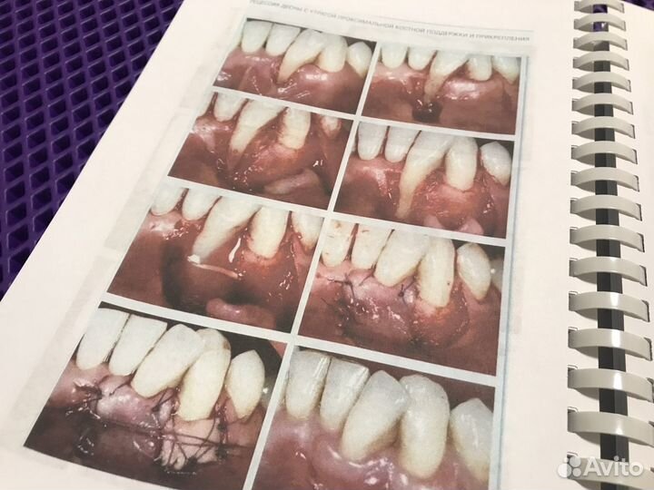 Пластическая хирургия мягких тканей полости рта