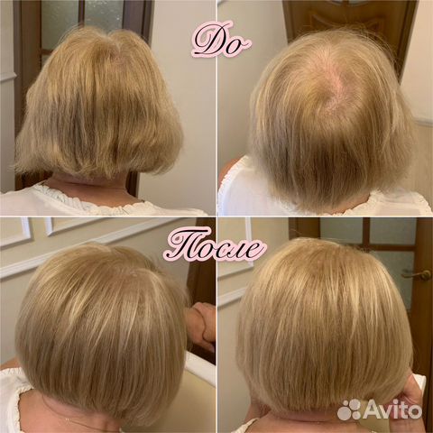 Прикорневой объем волос