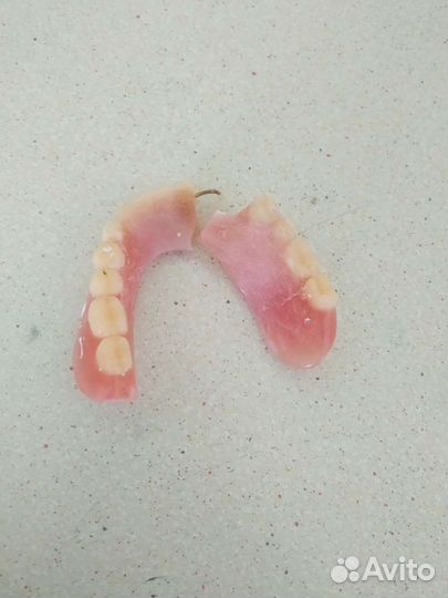 Съёмные протезы, несъёмные. Зубной техник