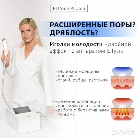 Аренда аппарата Ellisys plus S Игольчатый RF