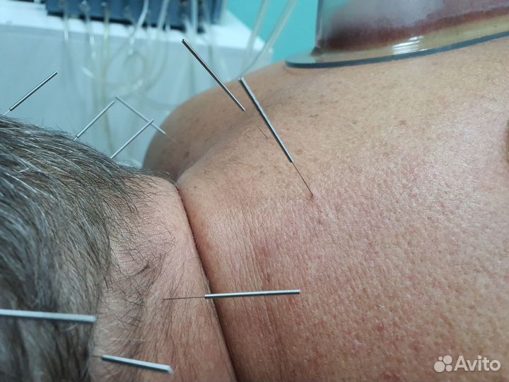 Сертификат на иголки