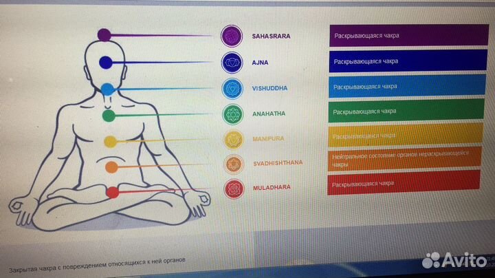 Продам (обмен) биорезонансный топ-аппарат