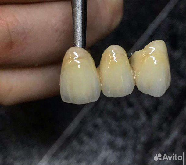 Зубной Техник