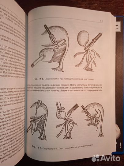 Оперативная лапароскопия в хирургии, гинекологии