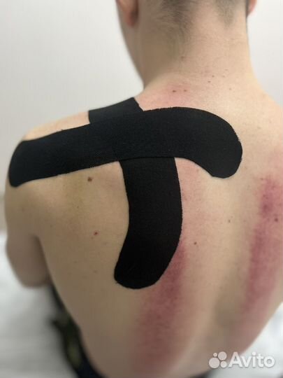 Антицеллюлитный массаж